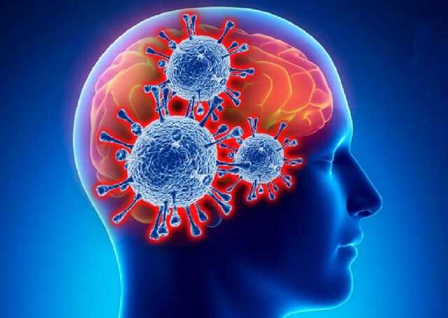 Ученые объяснили, почему у переболевших COVID-19 может ухудшаться память